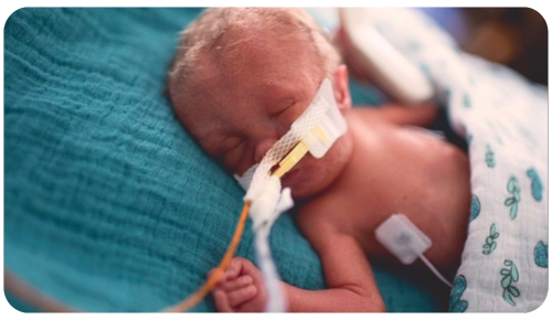 Miracle Hero Milo, a tiny infant born with a terminal genetic condition, rests on his hospital bed wearing breathing tubes and a heart monitor